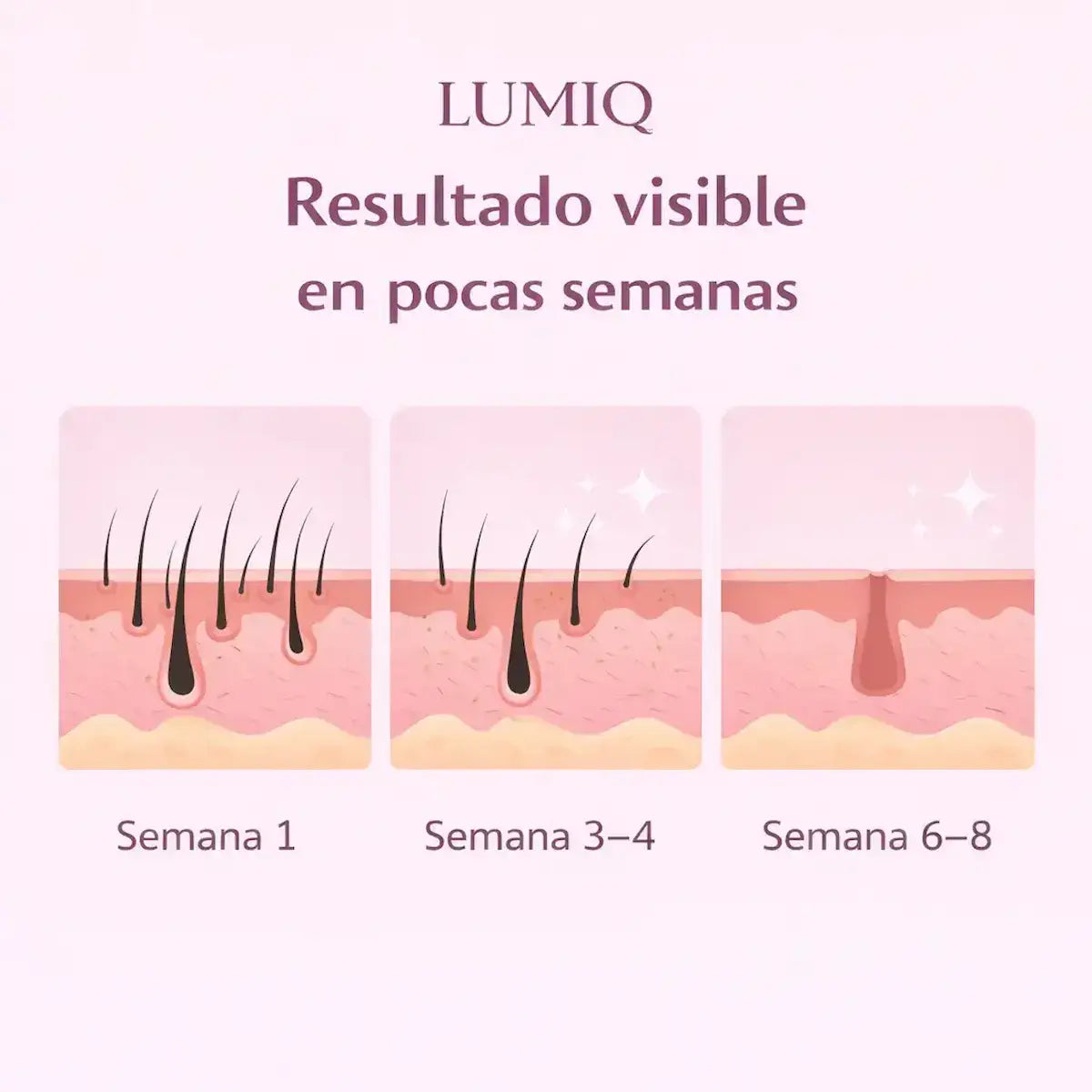 Depiladora Laser IPL Profesional